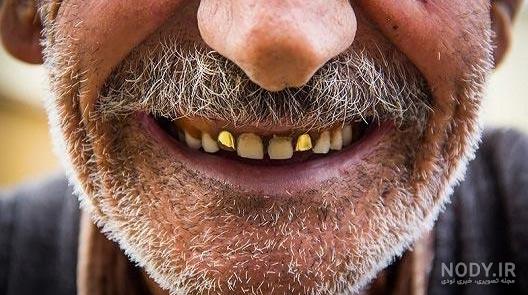 پروفایل خنده دار کرونا
