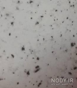 هایگلاس سفید اکلیلی