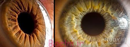 انشا در مورد چشم هایم انشا در مورد چشم هایم