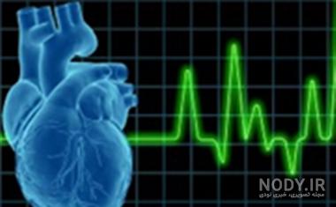 ضربان قلب پایین چند است