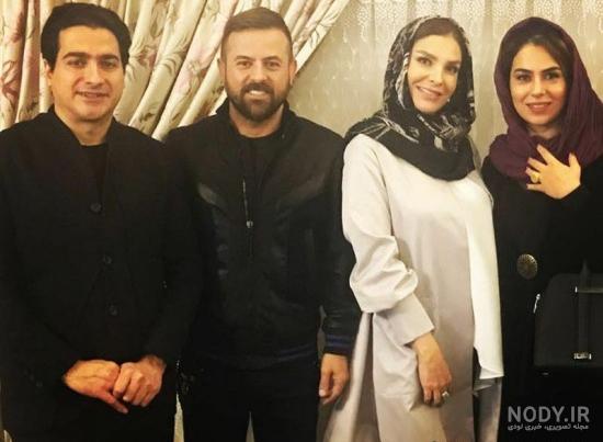 آزاده صمدی قبل از عمل بینی