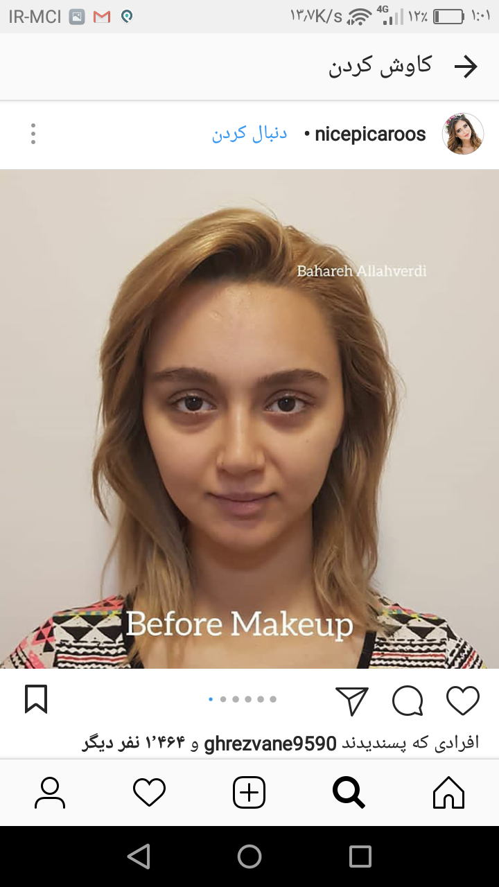 عکس شیرین محبت قبل از عمل