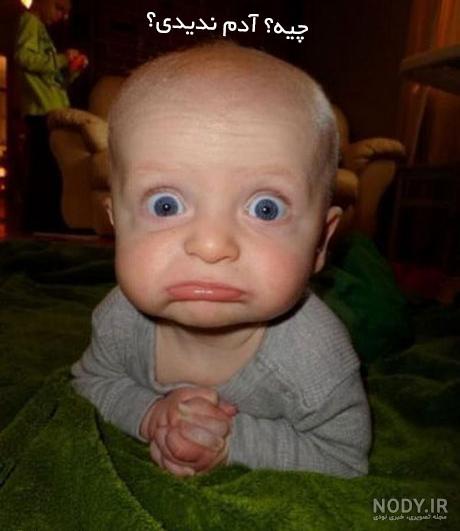 عکس بچه زشت و سیاه