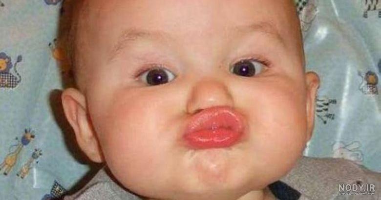 عکس بچه زشت و سیاه