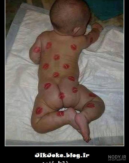 عکس بچه زشت و سیاه