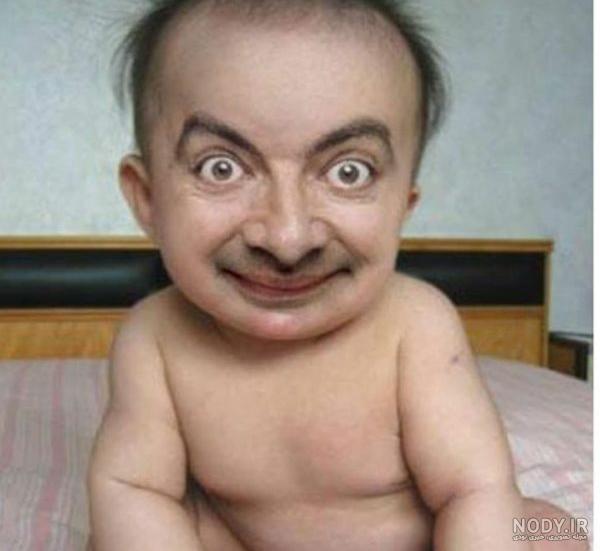 عکس بچه زشت و سیاه