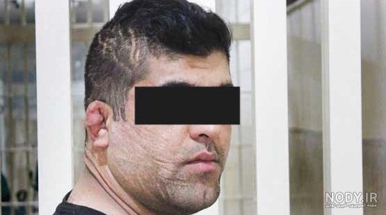 بازیگر صورت زخمی بازیگر صورت زخمی