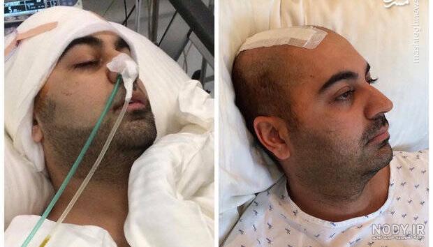 حسام نواب صفوی و دختر سرطانی