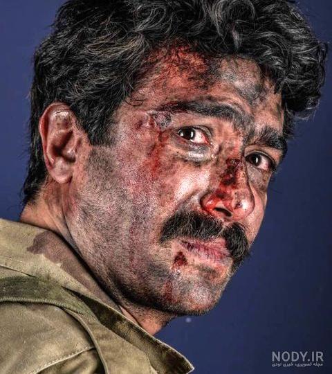 دانلود صورت زخمی دانلود صورت زخمی
