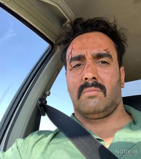 صوت دوبله فیلم صورت زخمی صوت دوبله فیلم صورت زخمی