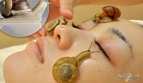 بعد از حلزون تراپی چه کنیم
