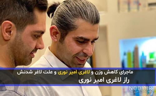 عمل لاغری امیر نوری