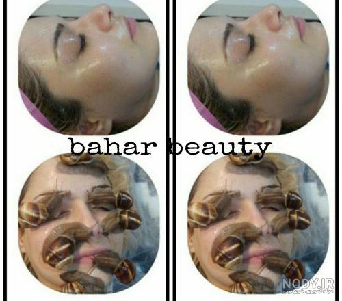 عوارض حلزون تراپی نی نی سایت