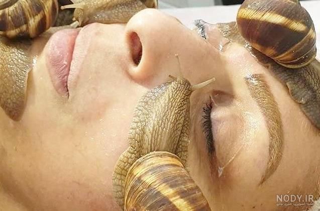 عکس قبل و بعد از حلزون تراپی
