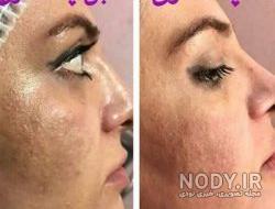 غذای حلزون تراپی