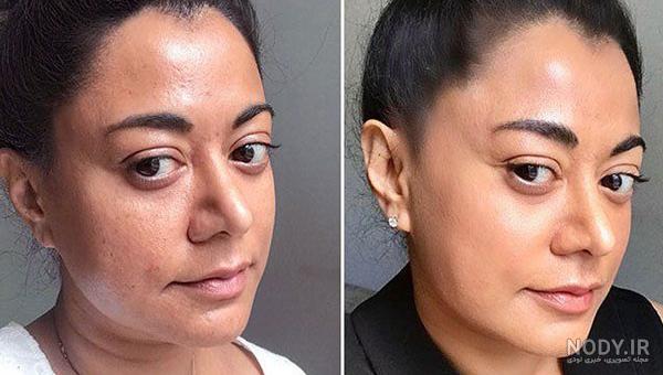 فیلم آموزش حلزون تراپی