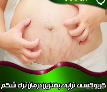 قیمت حلزون تراپی در شیراز