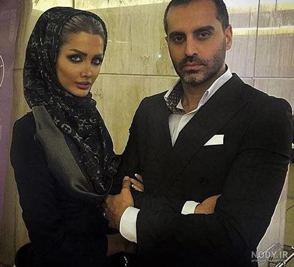 عکس صبا تاجیک قبل از عمل عکس صبا تاجیک قبل از عمل