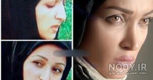 بازیگران مرد قبل و بعد از عمل بازیگران مرد قبل و بعد از عمل