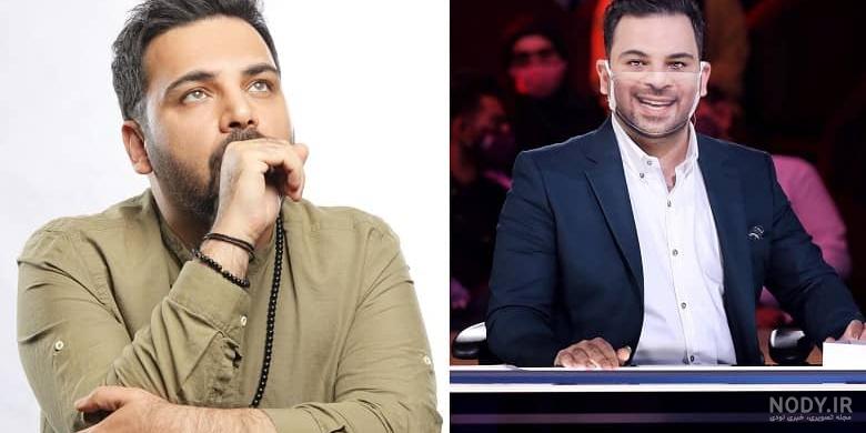 عکس احسان علیخانی قبل از عمل و کاشت مو