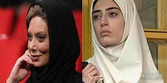 عکس بازیگران مرد ایرانی قبل و بعد از عمل زیبایی عکس بازیگران مرد ایرانی قبل و بعد از عمل زیبایی