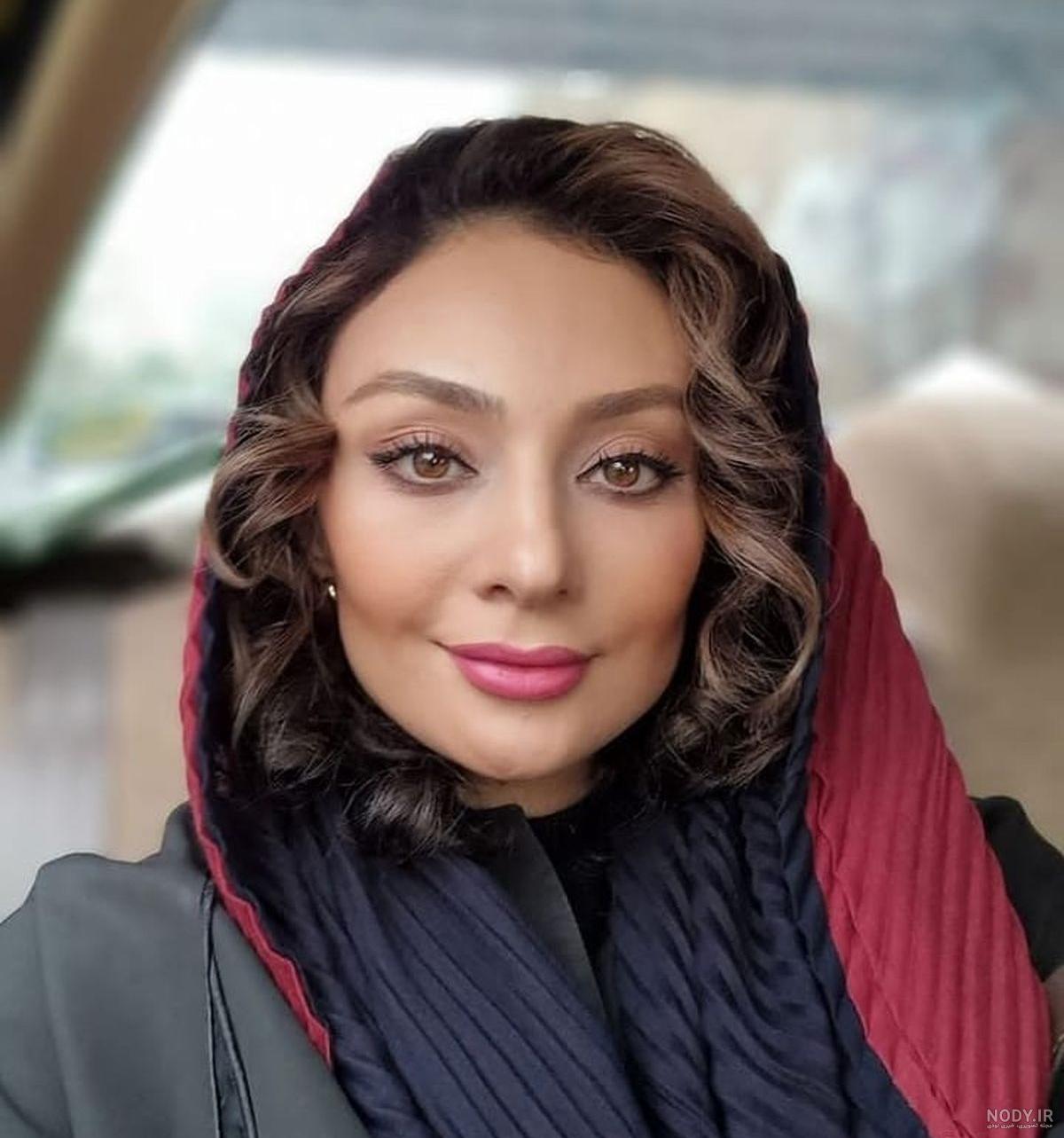 عکس خزان قبل از عمل بینی عکس خزان قبل از عمل بینی