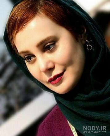 قبل و بعد عمل بینی بازیگران قبل و بعد عمل بینی بازیگران