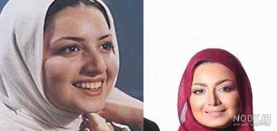 قبل و بعد عمل بینی بازیگران قبل و بعد عمل بینی بازیگران