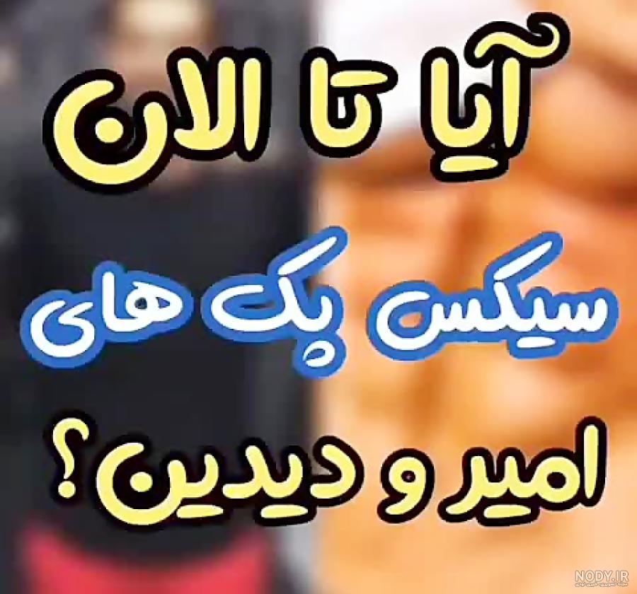 پای امیر مقاره چی شده پای امیر مقاره چی شده