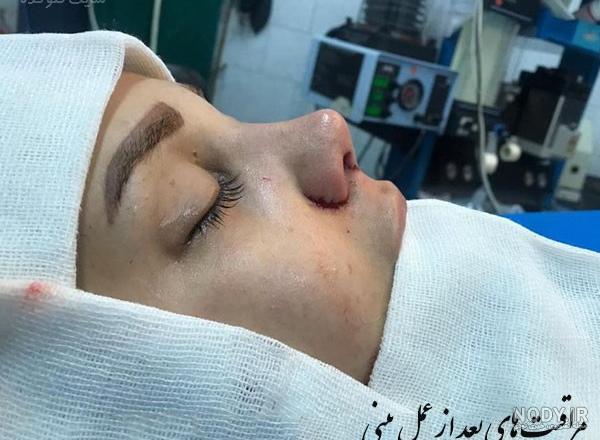 اسم قطره برای قرمزی چشم اسم قطره برای قرمزی چشم
