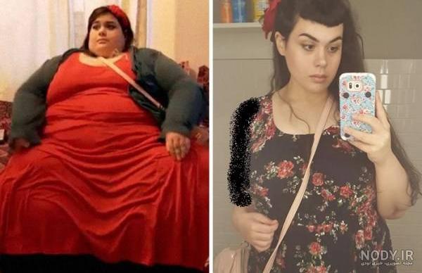 عکس قبل و بعد لاغری