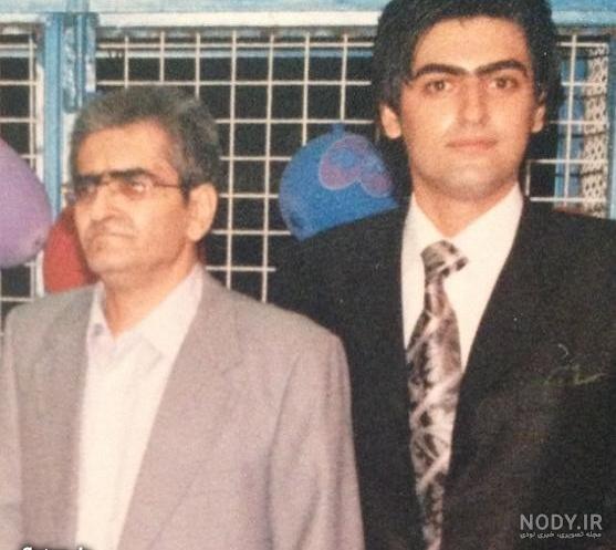 حسام نواب صفوی قبل از عمل بینی حسام نواب صفوی قبل از عمل بینی