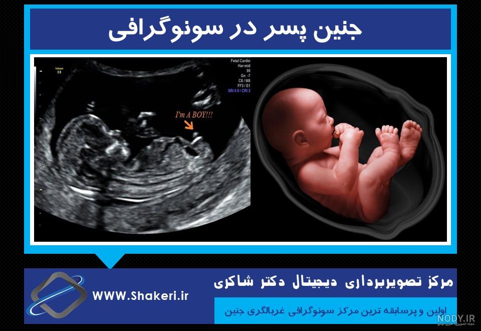 عکس جنین در هفته 18 بارداری