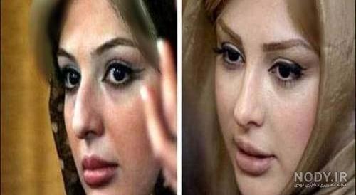 قبل و بعد عمل بینی بازیگران قبل و بعد عمل بینی بازیگران