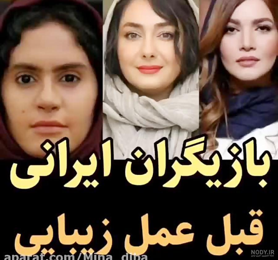 لیلی قبل از عمل لیلی قبل از عمل