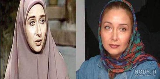 محمدرضا گلزار قبل از عمل بینی محمدرضا گلزار قبل از عمل بینی
