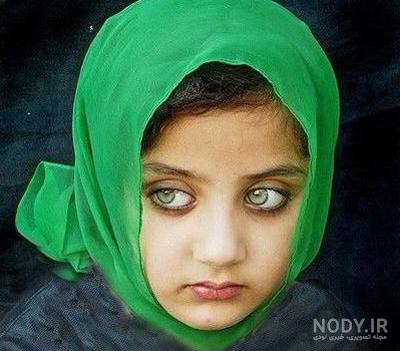 معایب چشم سبز معایب چشم سبز