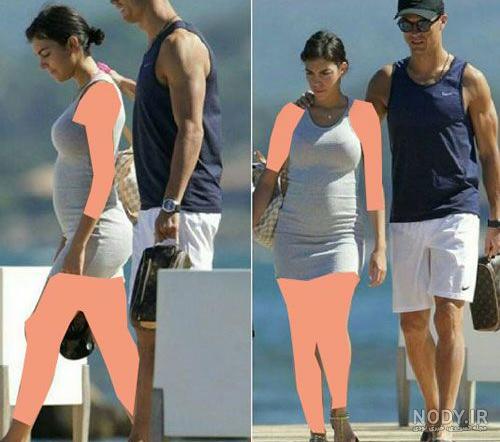 زایمان جورجینا همسر رونالدو طبیعی یا سزارین