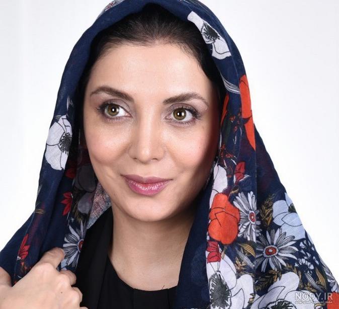 رویا میرعلمی قبل از عمل زیبایی رویا میرعلمی قبل از عمل زیبایی