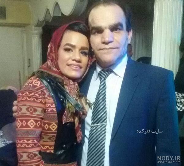 زهره فکور صبور قبل از عمل زهره فکور صبور قبل از عمل