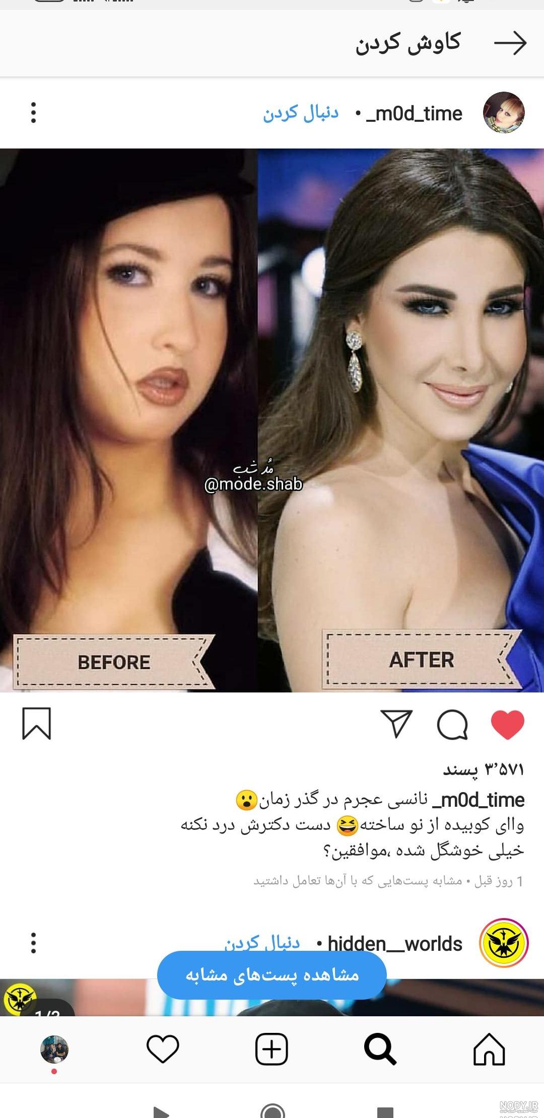 عکس نانسی عجرم قبل از عمل