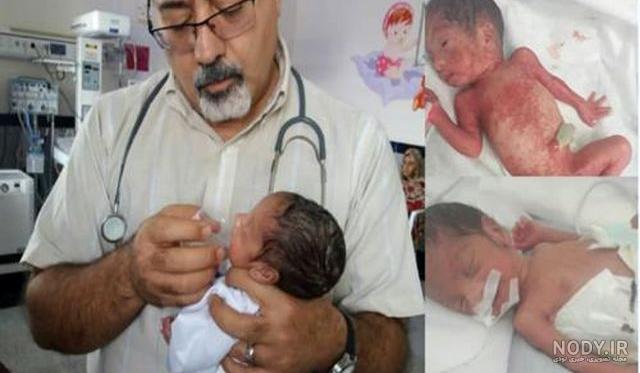 عکس سه ماهگی نوزاد دختر