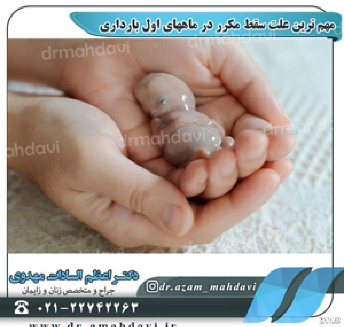 ایده عکس ماه های بارداری