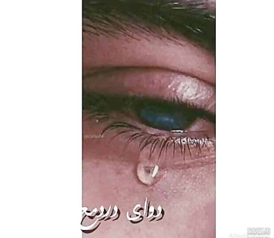 تصاویر چشم گریان متحرک تصاویر چشم گریان متحرک