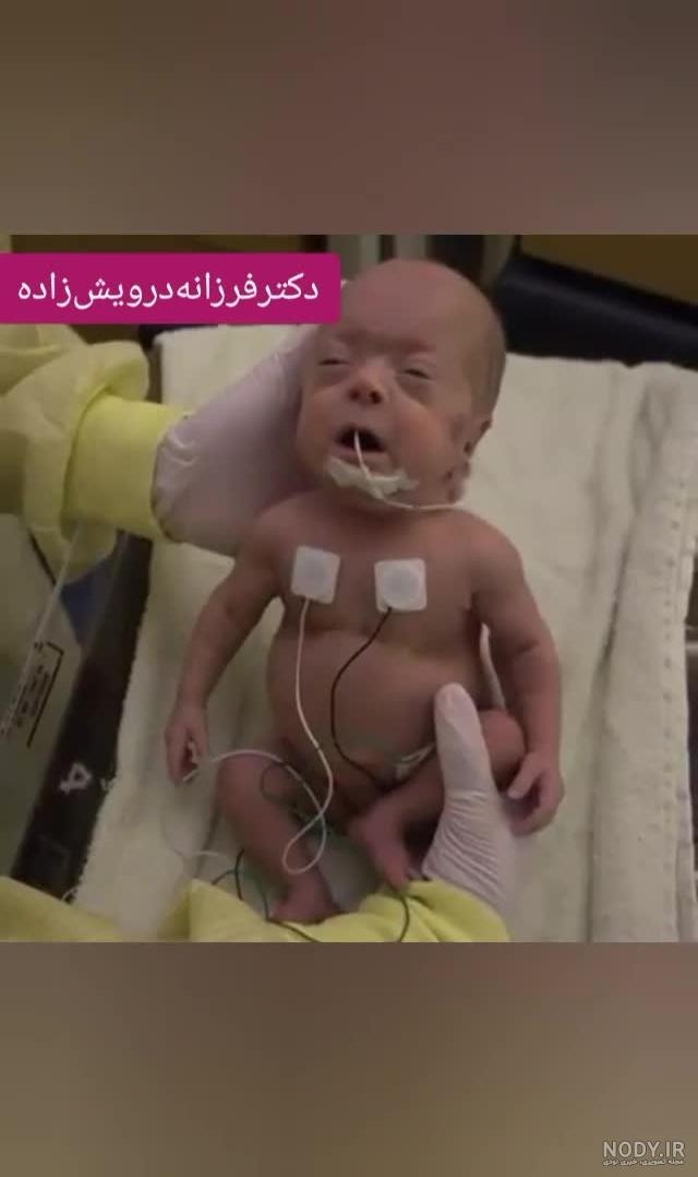 جنین شش ماهه در شکم مادر جنین شش ماهه در شکم مادر
