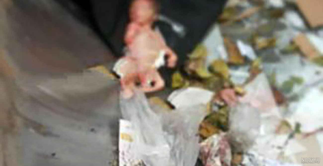 فیلم چرخش جنین در رحم فیلم چرخش جنین در رحم