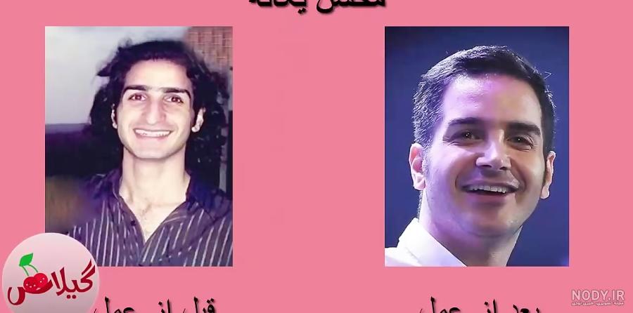 جراح بینی محسن یگانه