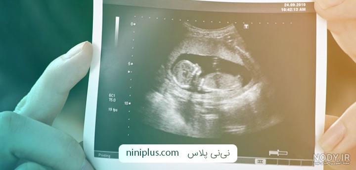 عکس جنین در هفته های مختلف