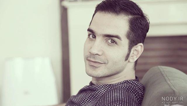 عکس محسن یگانه بعد از عمل بینی