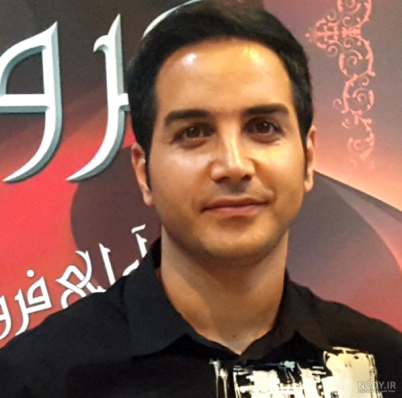 عکس محسن یگانه بعد از عمل بینی